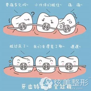 牙齿矫正好处