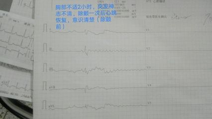 几个月有心跳