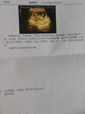 怀孕十七周有胎动吗