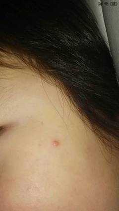 脸经常红是怎么回事