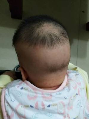 胎宝宝什么时候长头发