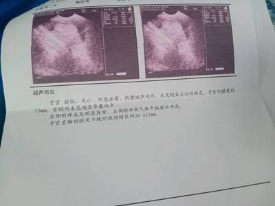 怀孕后白带多是怎么回事