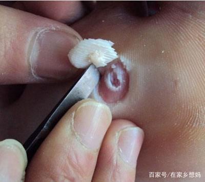 脚底疼痛怎么治疗