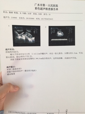 怀孕11周胎儿真实图片