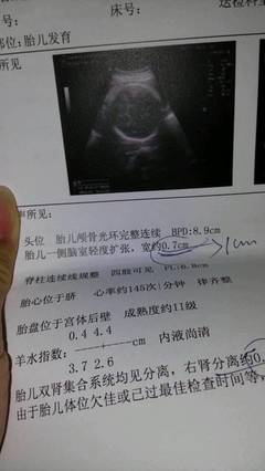 怀孕6个月做什么检查