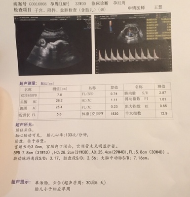 32周胎宝宝