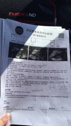 怀孕三个月宝宝
