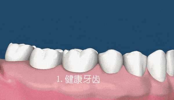 拔完牙齿出血怎么办