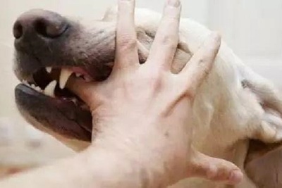 孕妇梦见狗咬手
