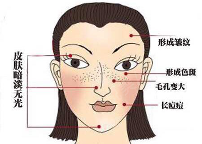 微针后长痘痘