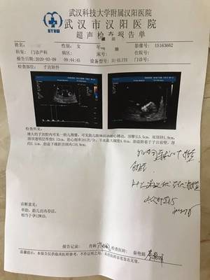 胎儿心率快