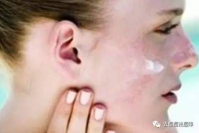 红血丝皮肤用什么面膜