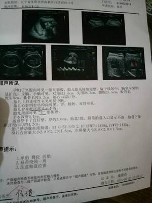 小排畸有宝宝照片吗