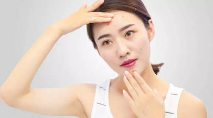 如何拯救痘痘皮肤