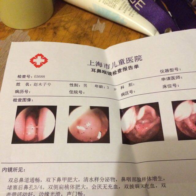 三岁宝宝扁桃体肥大怎么办