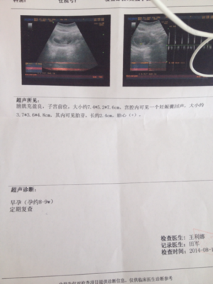 一般怀孕多久有心跳