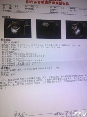 怀孕32周需要做什么检查