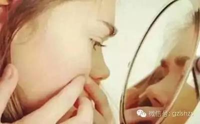 挤痘痘挤出白色的