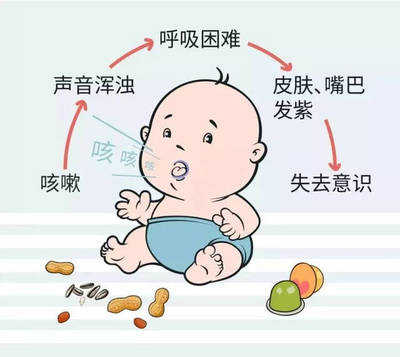 4岁宝宝咳嗽