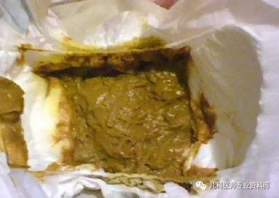 大便苦臭味是怎么回事