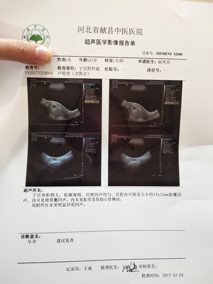 怀孕3个月孕囊多大