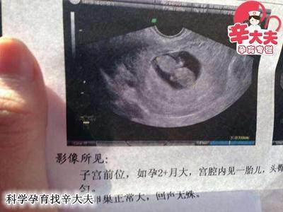 孕酮低胎儿发育正常
