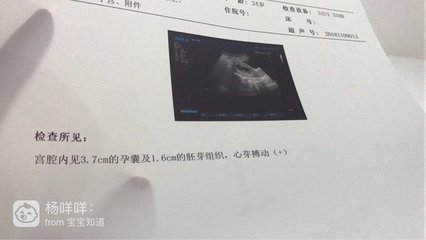 孕吐越厉害胎儿越稳定