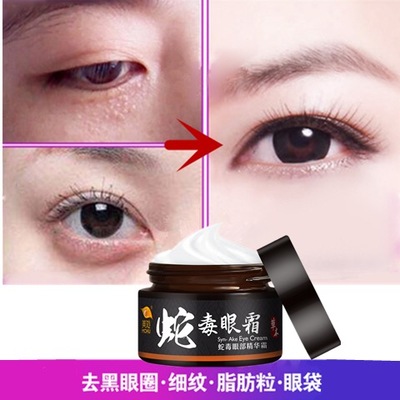 什么牌子眼霜去黑眼圈眼袋效果好