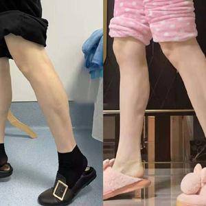 瘦腿哪里整容