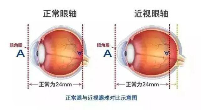 眼底出血 手术多少钱