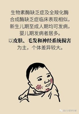 三个月宝宝有湿疹怎么办