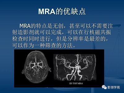 mra和cta的区别