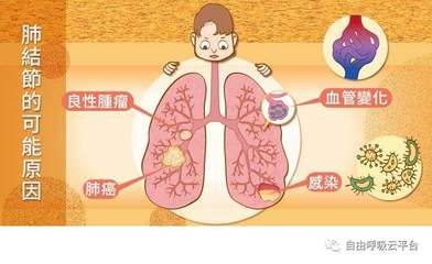 肺结节是怎么回事