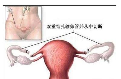 月经不调怀孕的几率大不大