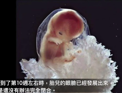 孕11周是几个月