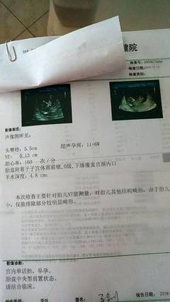 怀孕前会出血吗
