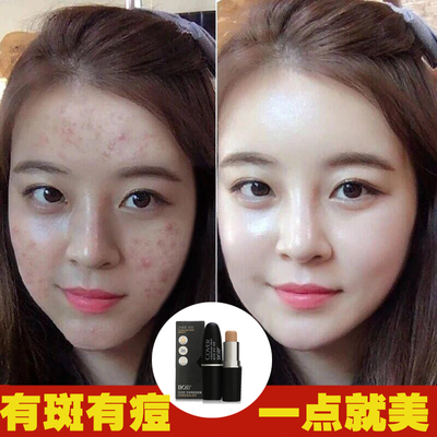痘痘能不能遮瑕膏