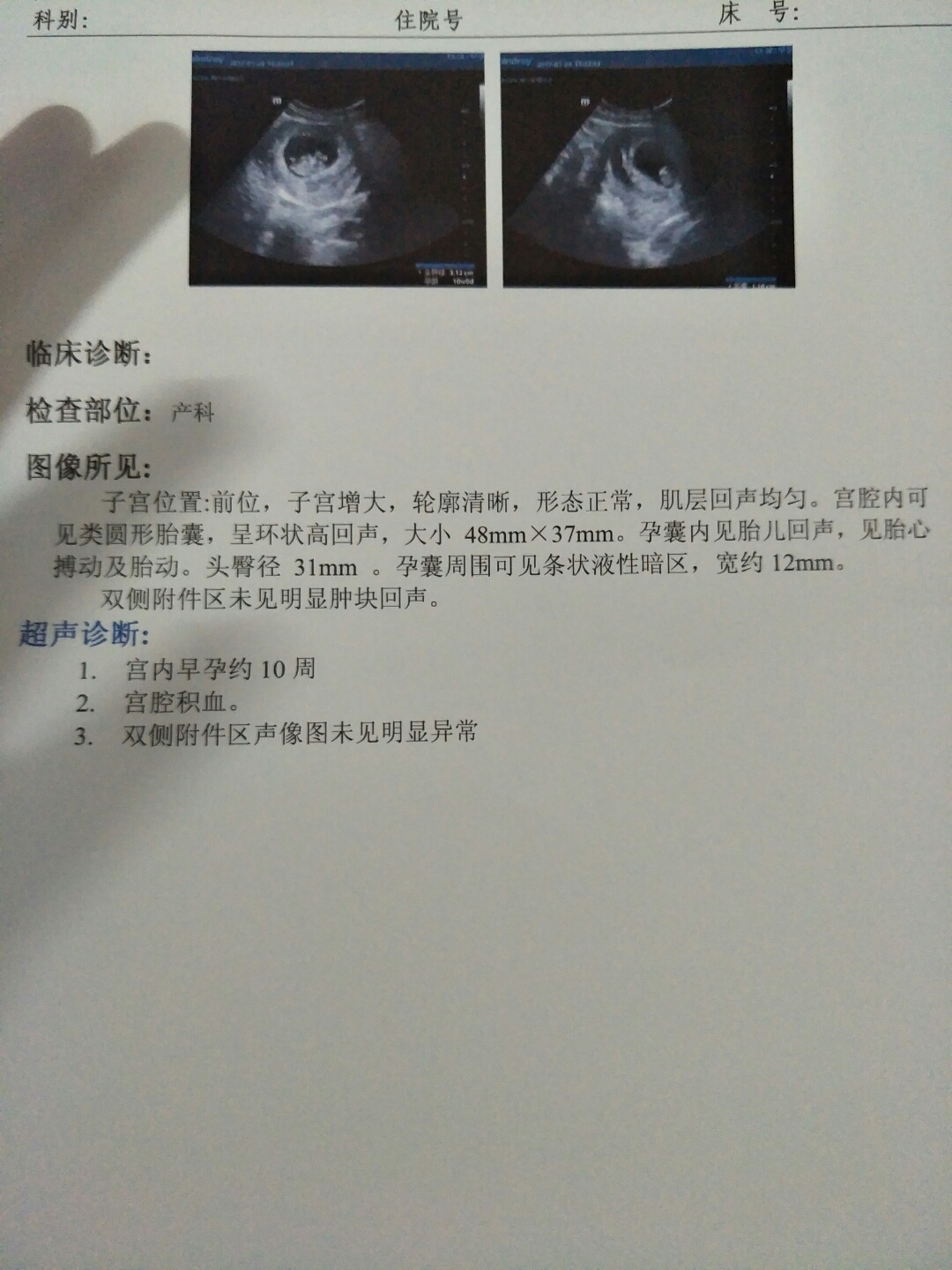 怀孕出血量