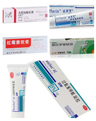 祛痘印的药膏有哪些