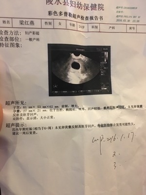 一般几天会怀孕