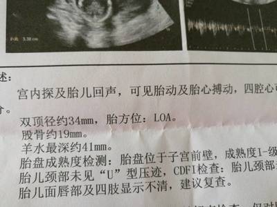 四个月胎动