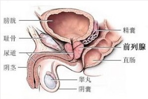 看前列腺肥大要多少钱