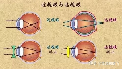 花眼是怎么回事