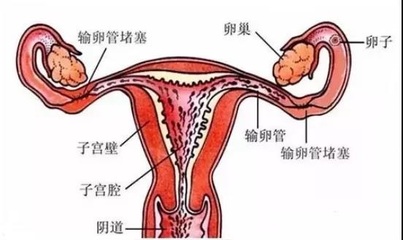一个卵巢可以怀孕吗
