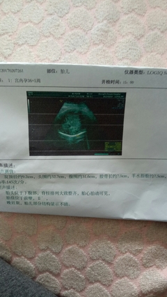 怀孕心率多少算正常