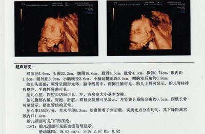 胎儿22周图片