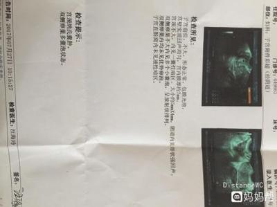 双侧卵巢多囊会怀孕吗