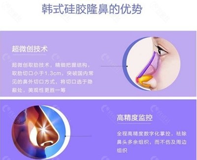 贵阳利美康隆鼻价格