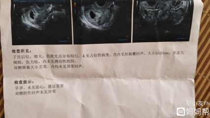 停经8天能测出怀孕吗