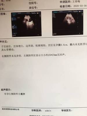 怀孕几周是一个月
